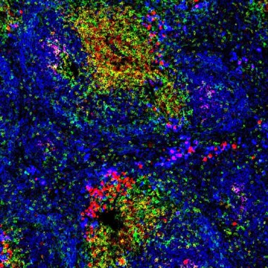 L\'efficiente collaborazione tra cellule T e cellule B guida il bias degli epitopi degli autoanticorpi e l\'insorgenza della malattia celiaca